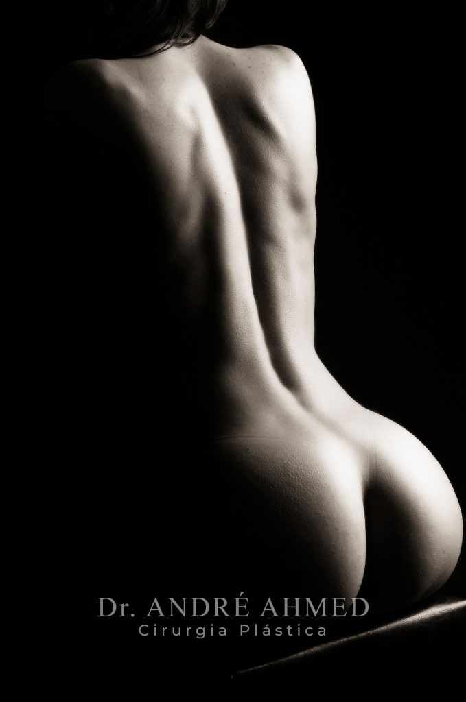 Gluteoplastia15