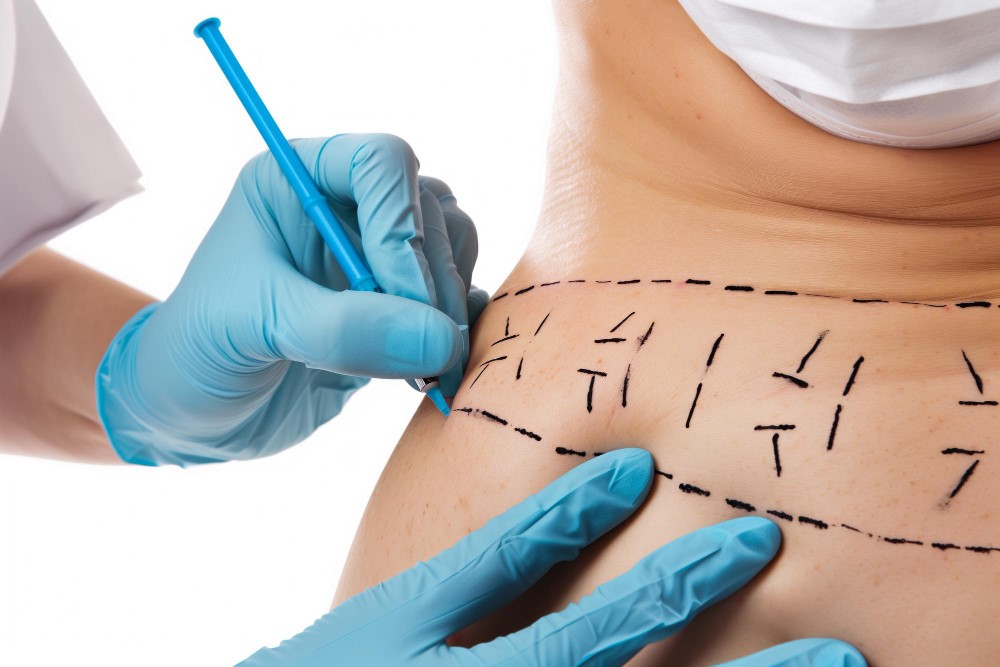 Por Que Chama Cirurgia Plastica