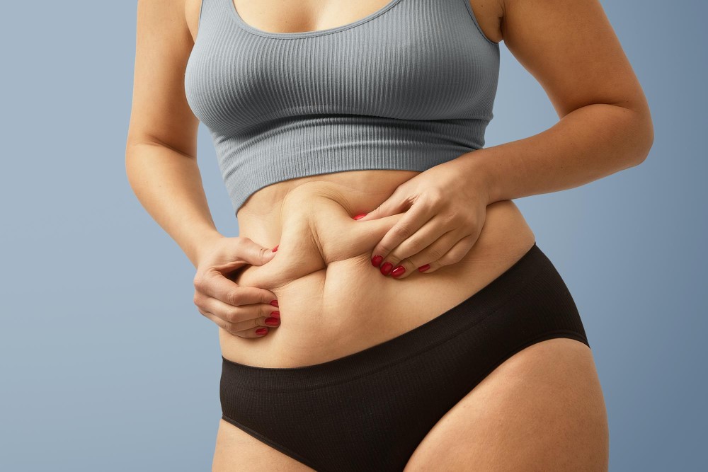 Quantos Quilos Precisa Perder para Fazer Abdominoplastia
