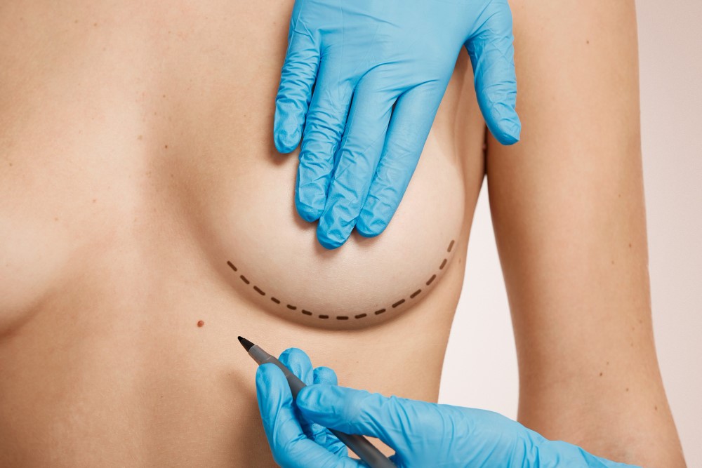 Quantas Pessoas Fazem Cirurgia Plastica no Brasil por Ano 1