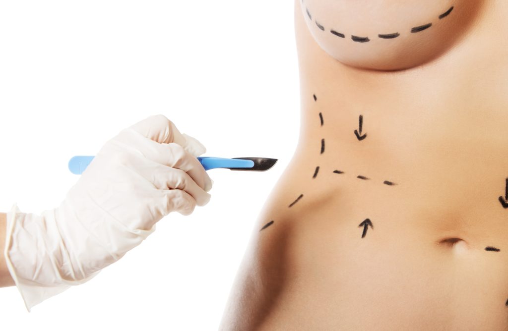 Por Que as Pessoas Fazem Cirurgia Plastica 1