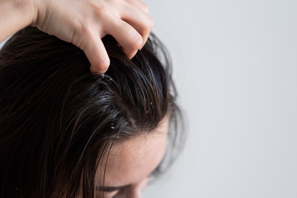 O Silicone Pode Causar Queda de Cabelo 1