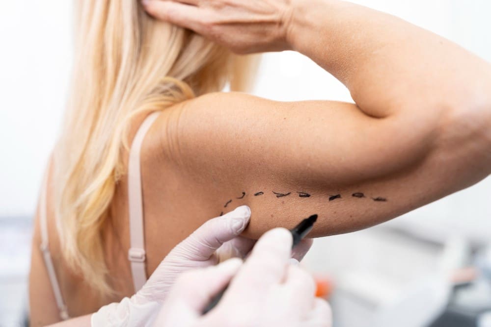 Cirurgia Plastica Pos Bariatrica no Brasil