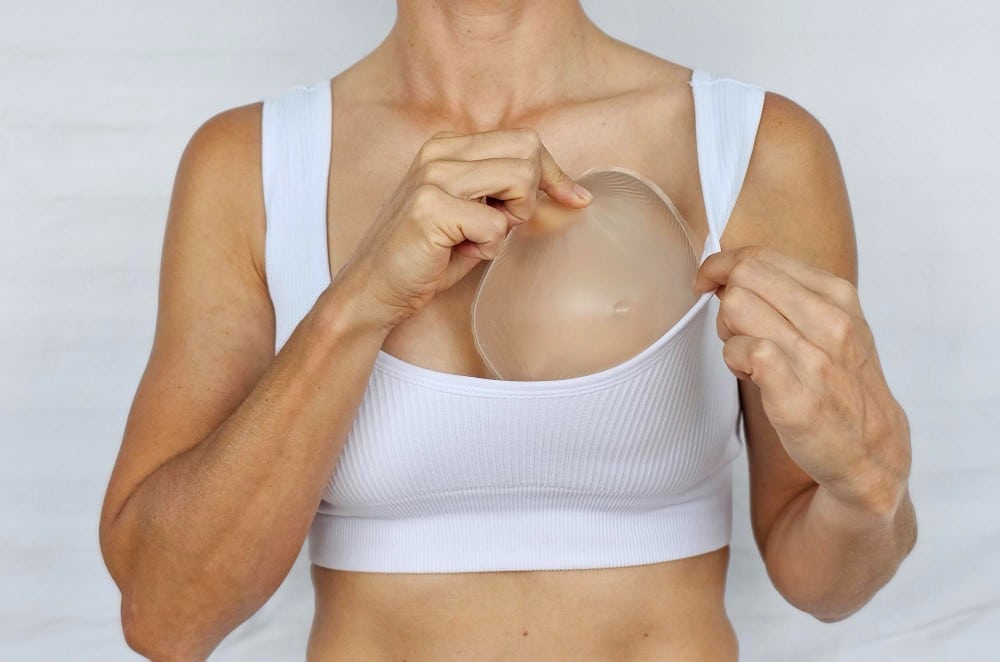 Mamoplastia Resultados Naturais 1